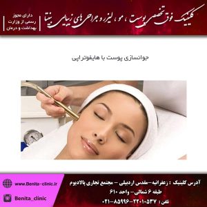 جوانسازی پوست با هایفوتراپی