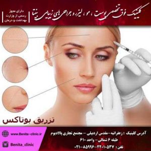 تزریق بوتاکس