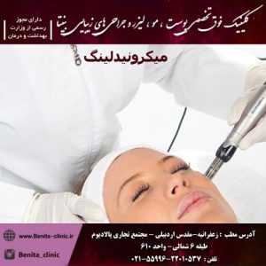 میکرونیدلینگ