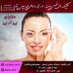 مزایای پی آر پی