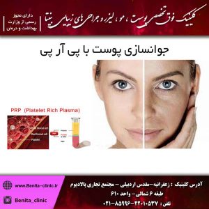 جوانسازی پوست با پی آر پی