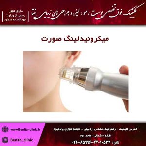 میکرونیدلینگ صورت