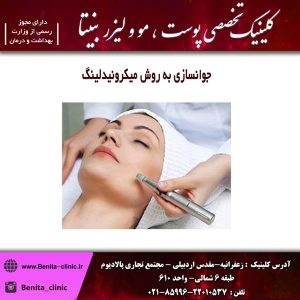 جوانسازی به روش میکرونیدلینگ