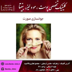 جوانسازی صورت