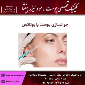 جوانسازی پوست با بوتاکس 