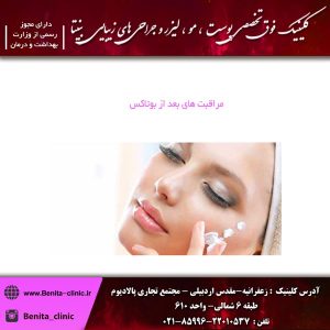 مراقبت های بعد از بوتاکس